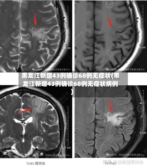 黑龙江新增43例确诊68例无症状(黑龙江新增43例确诊68例无症状病例)-第3张图片